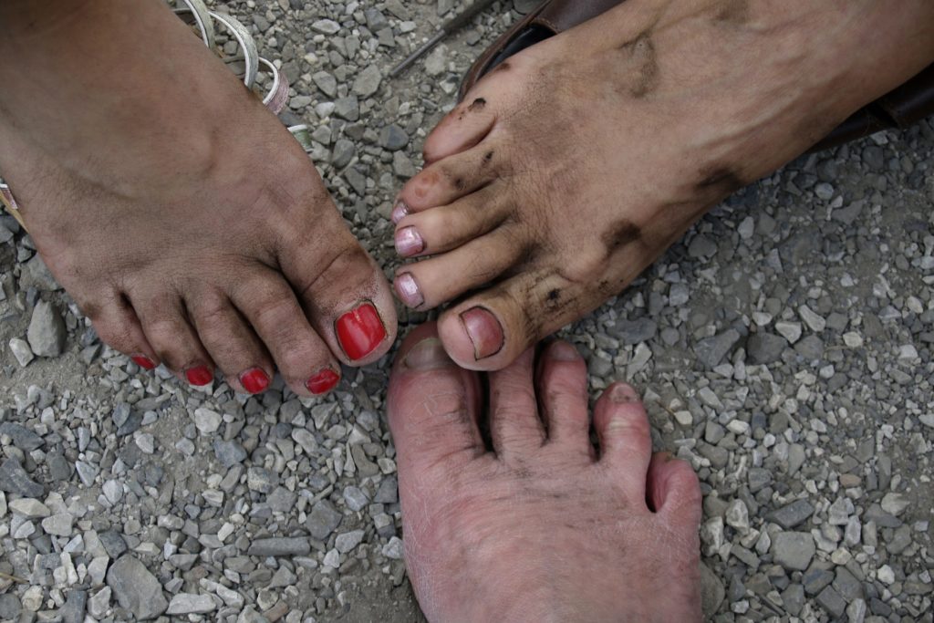 Hikers get dirty feet. Keeping them clean can help prevent blisters. Find out how to prevent blisters when hiking, and how to treat blisters on the trail.